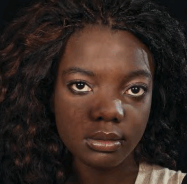 filler-complication-3